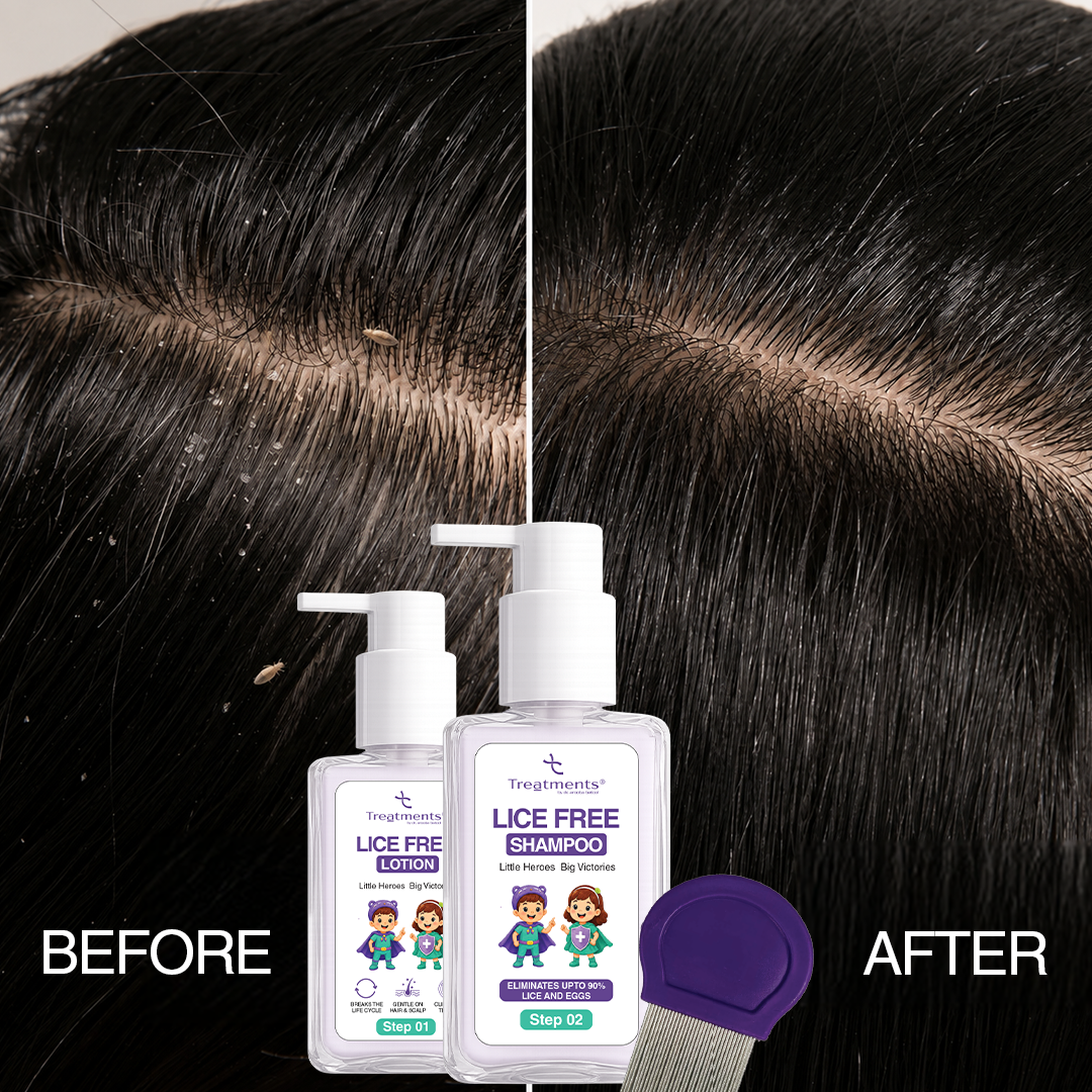 Anti-Lice Duo — Lice-Free Lotion + Anti-Lice Shampoo