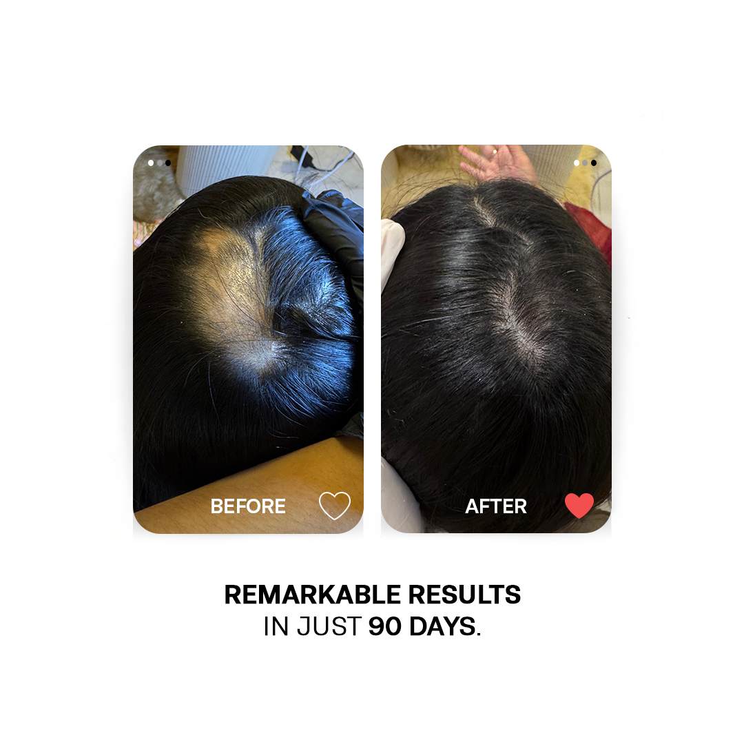 Caffeine Hair Growth Combo