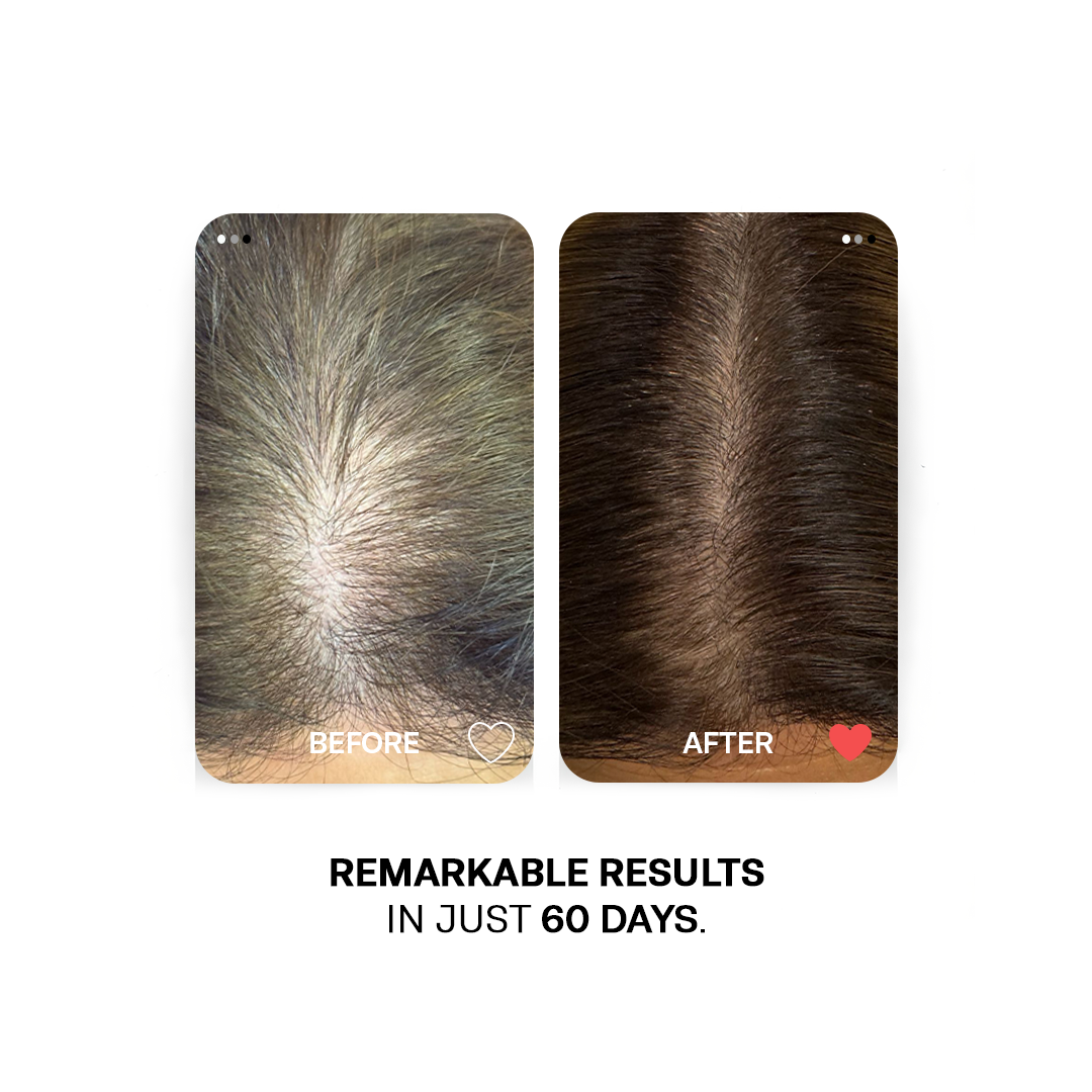 Extreme Hair Growth Oils Bundle