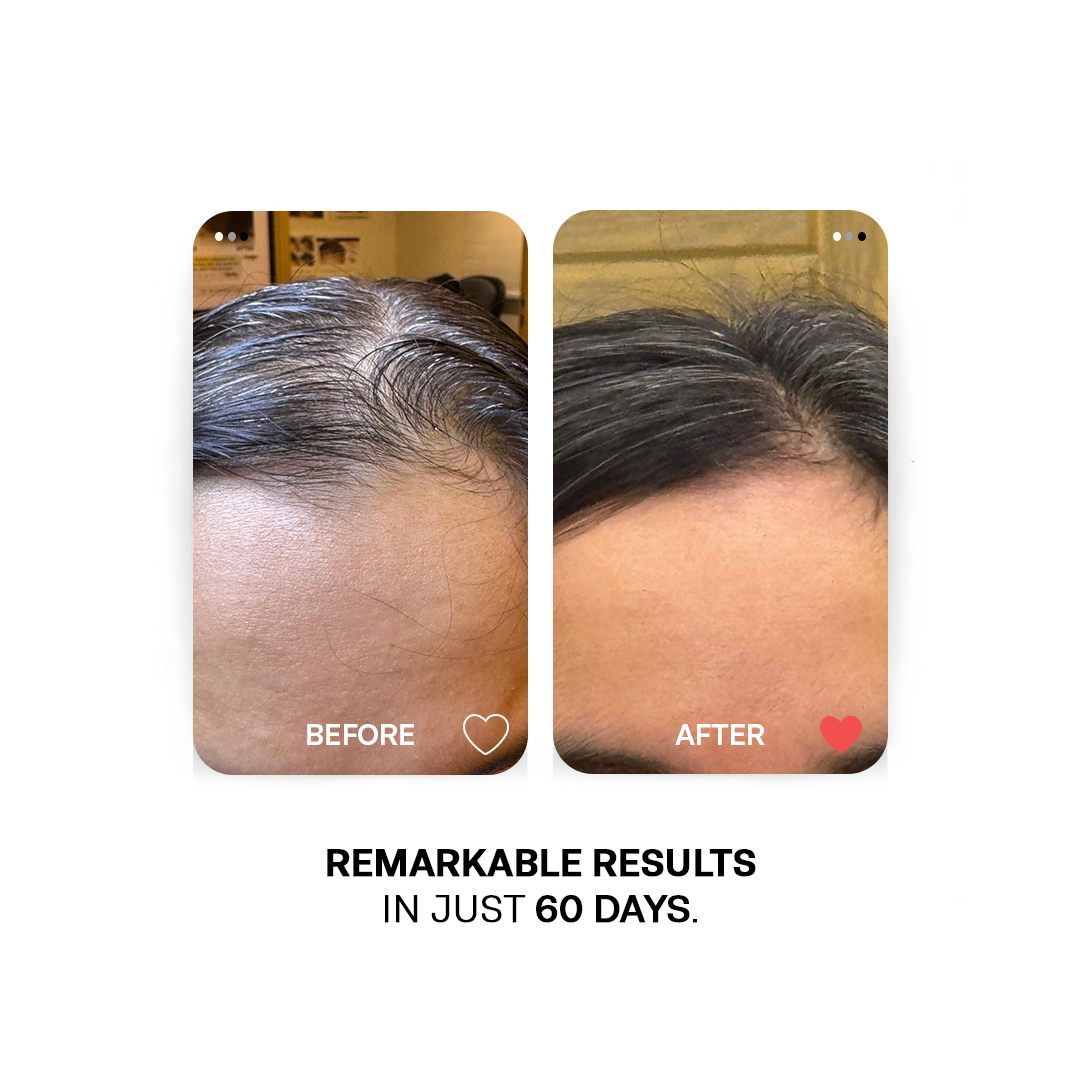 Nourishing Hair Trio Bundle: 3-Oil Bundle for Healthy, Vibrant Locks