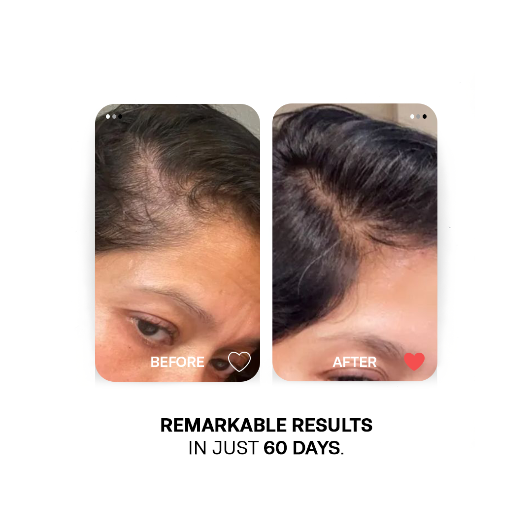 Onion Essential Oil - Scalp Repair Root Strengthening