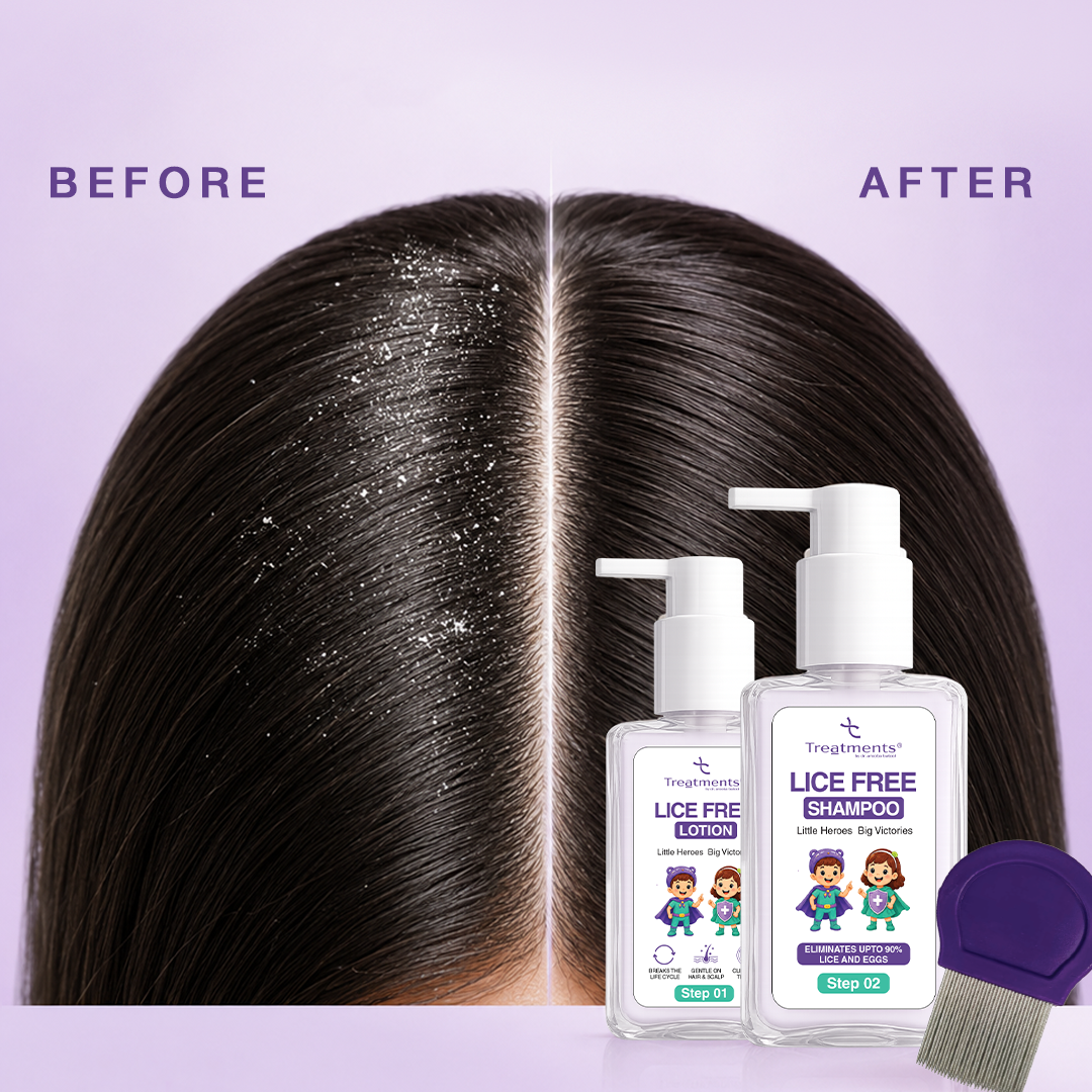 Anti-Lice Duo — Lice-Free Lotion + Anti-Lice Shampoo