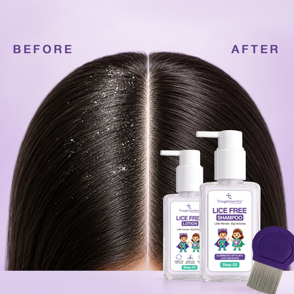 Anti-Lice Duo — Lice-Free Lotion + Anti-Lice Shampoo