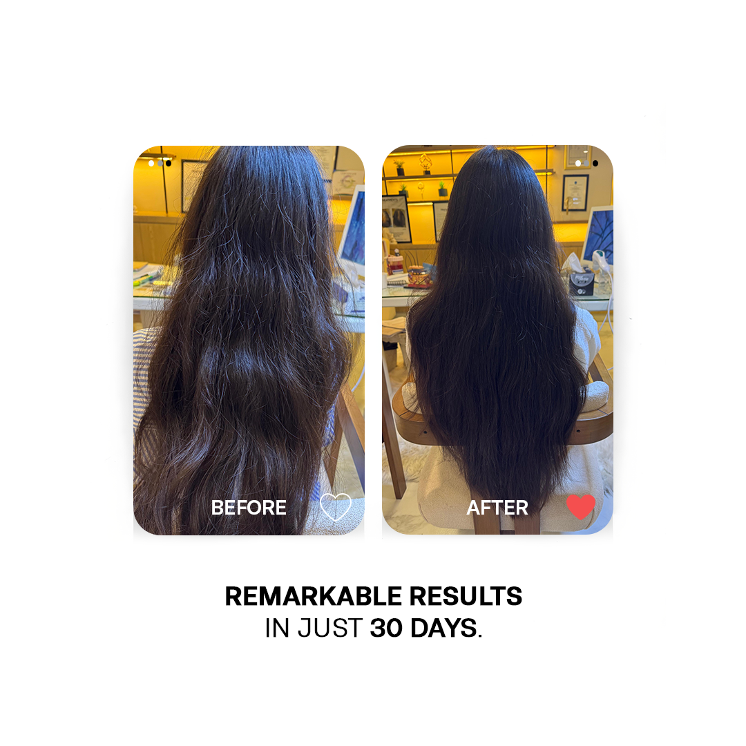 30 Days Hair Growth Trio -  Deal of The Year - Avail Flat 25% Off