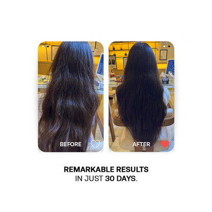 30 Days Hair Growth Trio -  Deal of The Year - Avail Flat 25% Off