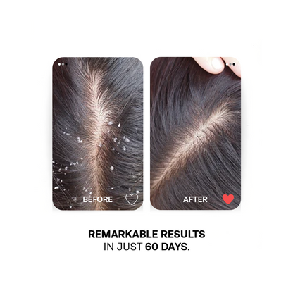 Anti Dandruff Rescue Shampoo