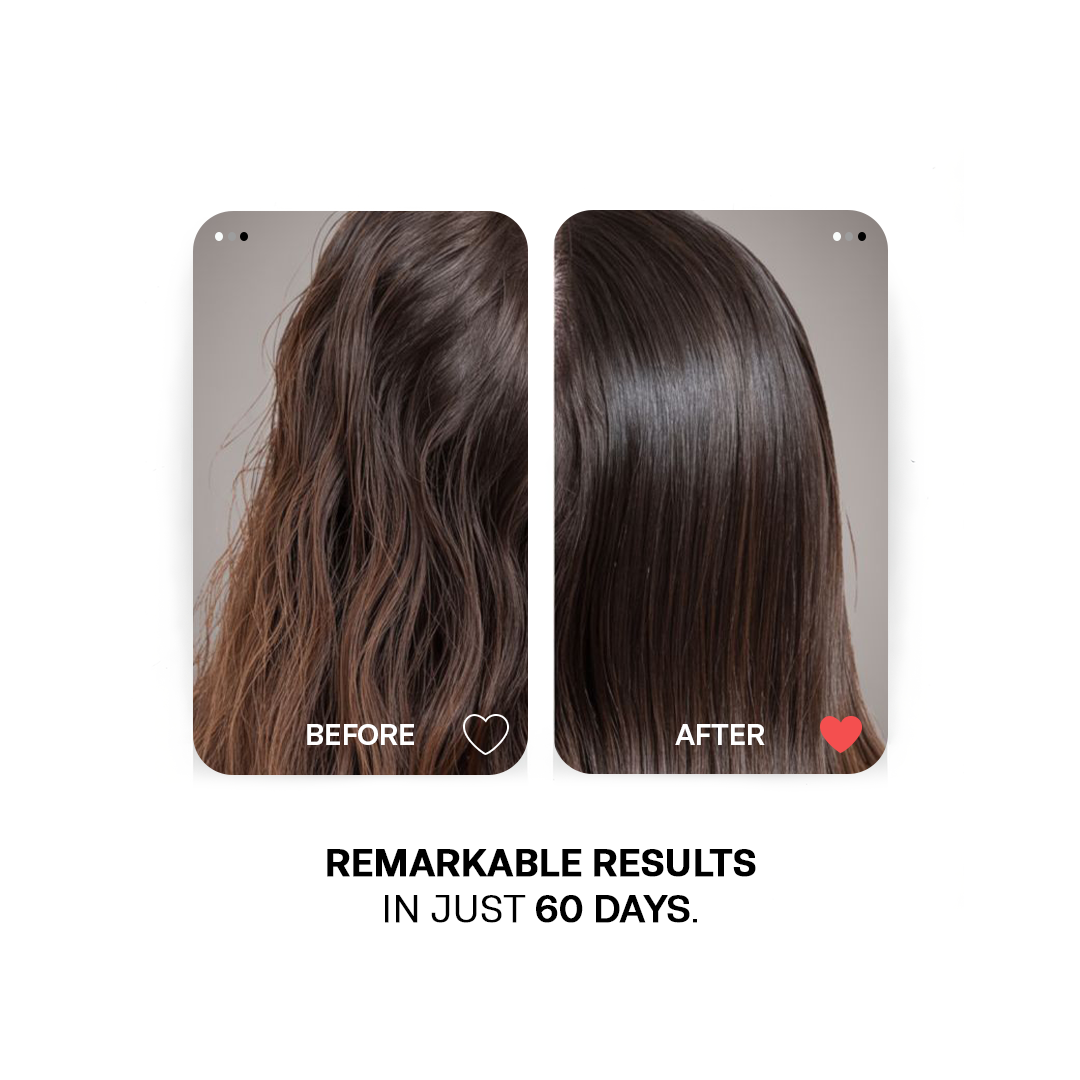 Black Caster Essential Oil - Scalp Strengthening Hair Growth Booster