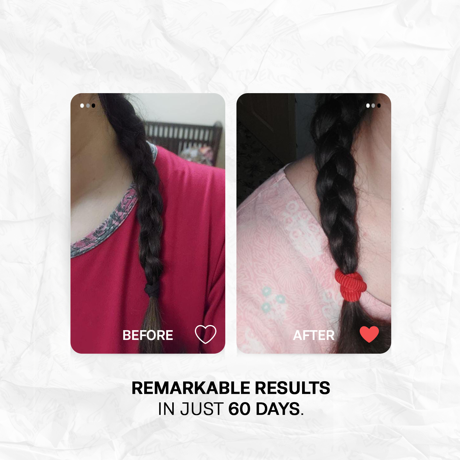 Medicated Hair Loss Advanced Solution