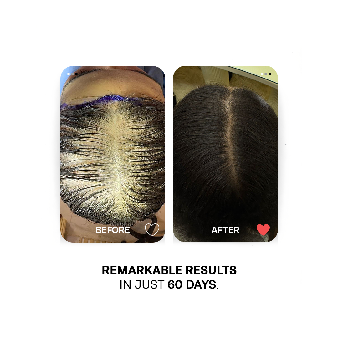 Hair growth Must Haves