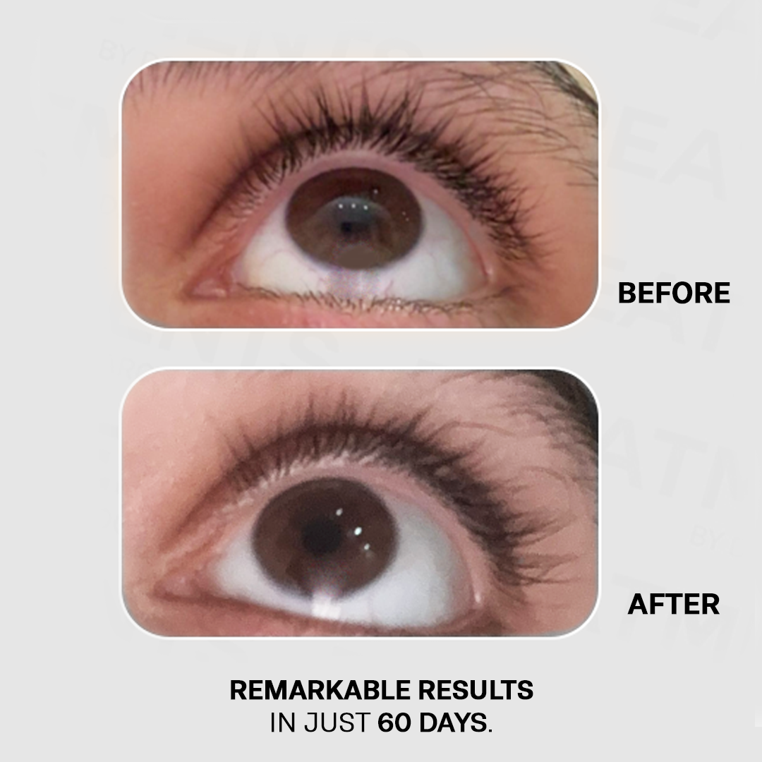 Medicated Lash Length Advance Solution