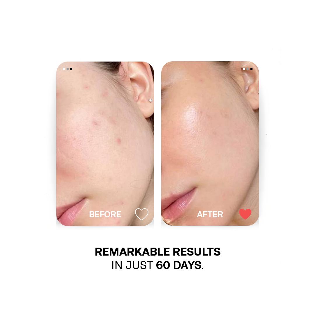 Vitamin E Essential Oil - Antioxidant Repair Skin &amp; Hair Nourishment